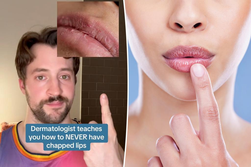 The Dermatologist's 3 Steps to No More Chapped Lips - Just Slap, Slap and Dab